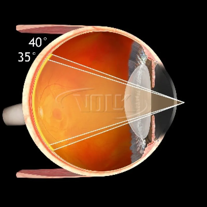 Fundus Купити Fundus Україна