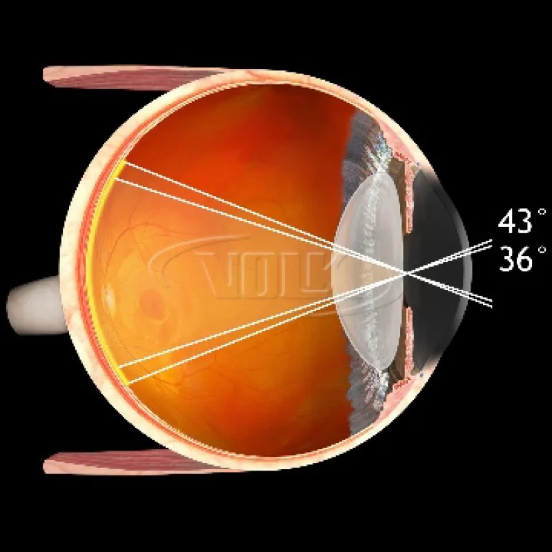 Класична лінза Macula Plus® 5.5 Купити Класична лінза Macula Plus® 5.5 Україна