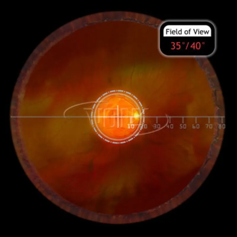 Fundus Купити Fundus Україна