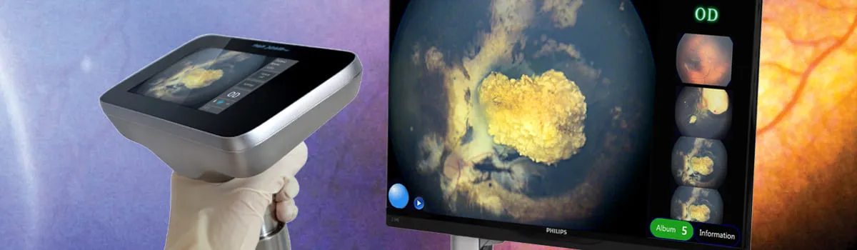 Педіатрична система PanoCam PRO Купити Педіатрична система PanoCam PRO Україна