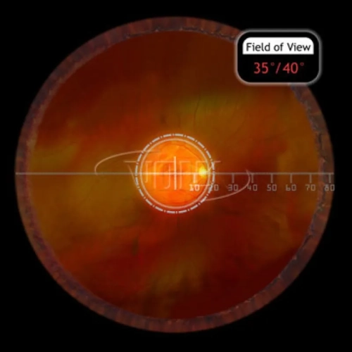 Fundus